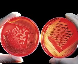 Proteínas recombinantes